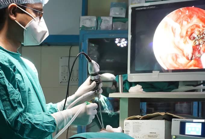 best ent surgeon in Kolkata - Dr. Rahul Sarkar